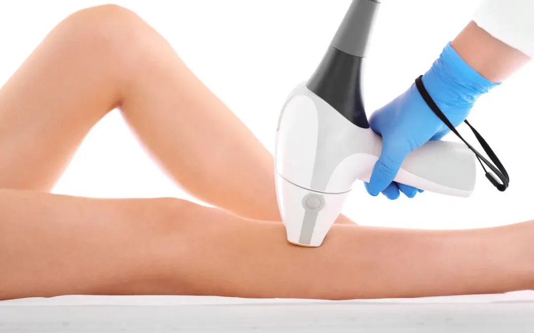 Czy depilacja laserowa działa na każdy typ skóry?