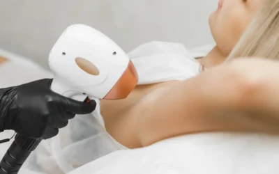 Dlaczego laserowe usuwanie owłosienia to inwestycja na lata