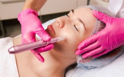 Czy mikrodermabrazja może zmienić wygląd Twojej sk&oacute;ry w kilka sesji