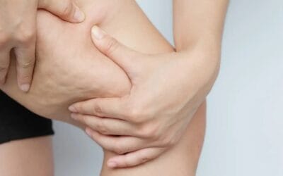 Unikalna technologia w walce z cellulitem