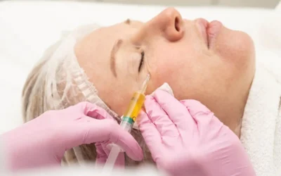 Dlaczego wampirzy lifting to ceniony trend w medycynie estetycznej