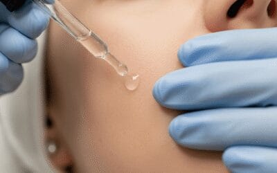 Czy usuwanie pieprzyk&oacute;w zostawia blizny